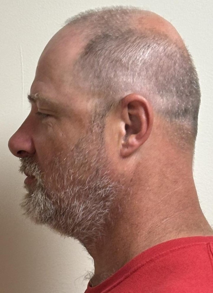Mugshot Side